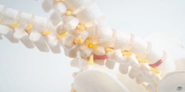 Bel Kayması (Spondilolistezis) ve Ameliyatı Hakkında Bilmeniz Gerekenler