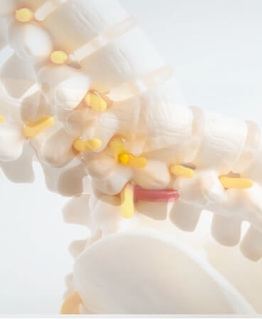 Bel Kayması (Spondilolistezis) ve Ameliyatı Hakkında Bilmeniz Gerekenler